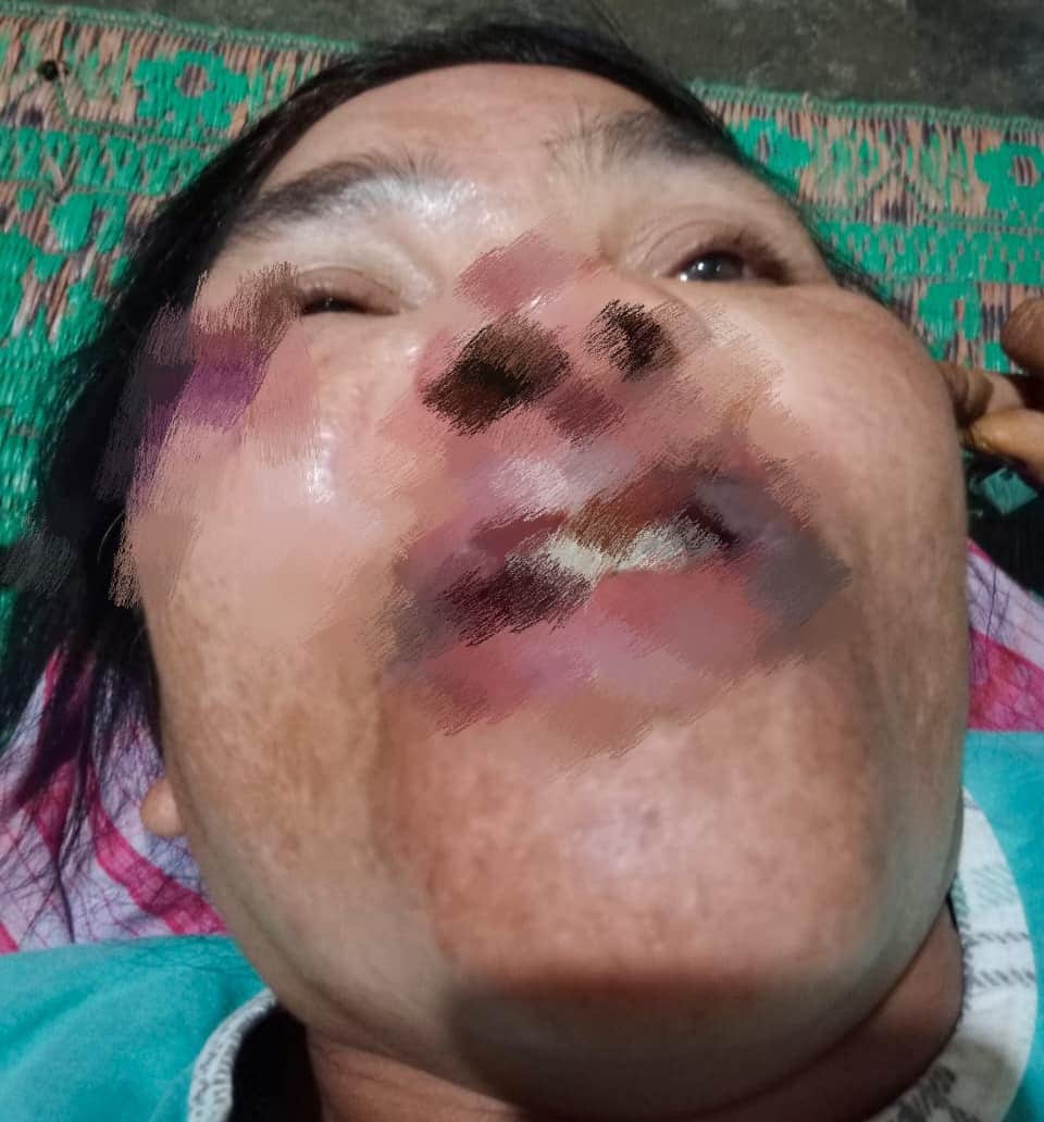 Foto: Salah seorang karyawati yang menjadi korban dugaan tindak pidana pengeroyokan dan penganiayaan yang diduga dilakukan tim oknum provokator, di Wilayah Kebun PT SPR, Rabu (23/8/2023). (kedannews.com/istimewa).